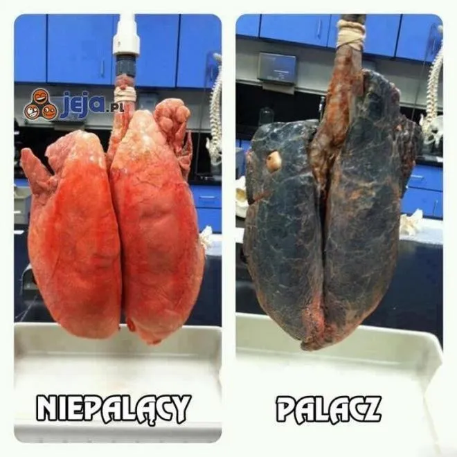 Jakie zmiany w płucach powoduje palenie tytoniu? Od stanu zapalnego do POChP