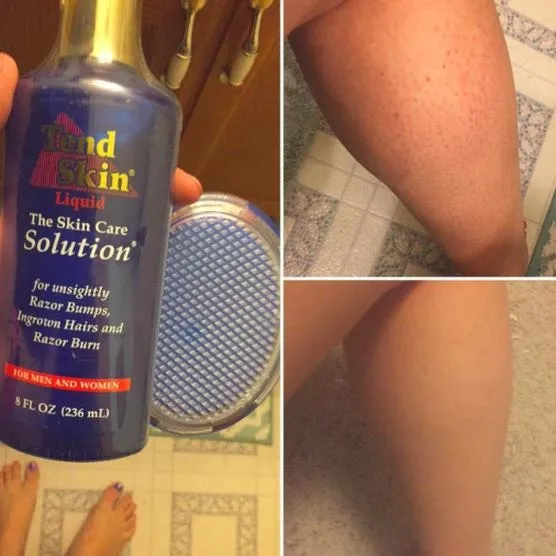 Tend Skin Liquid – gdzie znaleźć oryginalny produkt w dobrej cenie?
