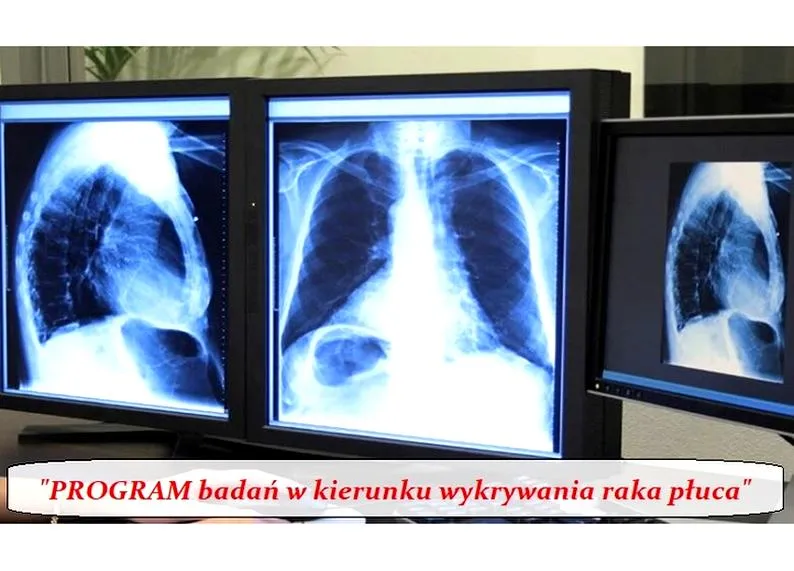 Diagnostyka raka płuc