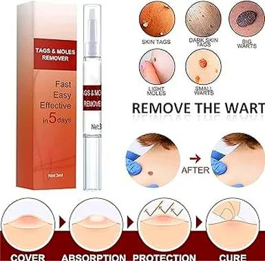 Liquid wart flat