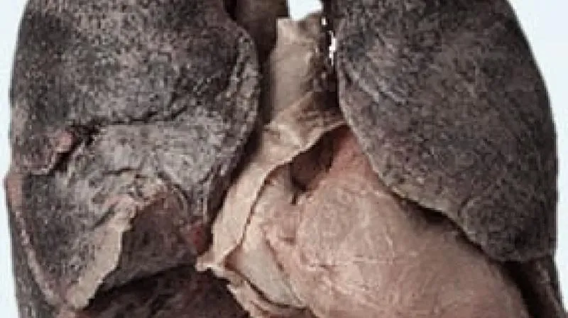 Palenie tytoniu